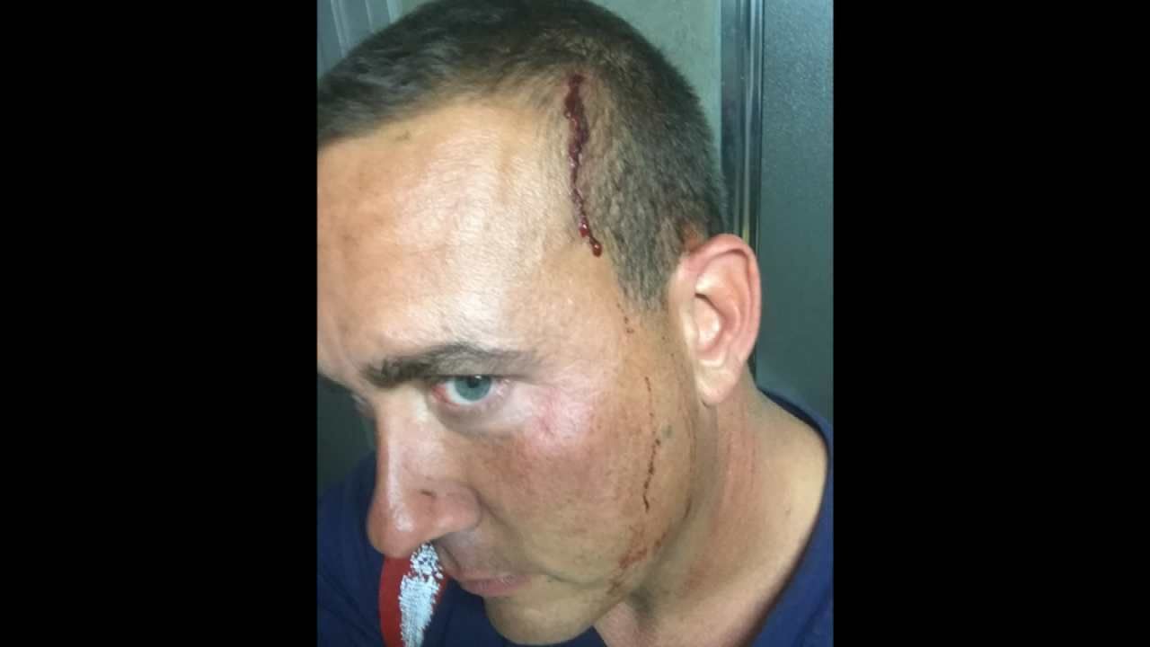 Tulsa Firefighter Recovering After Being Attacked Trying To Save Man