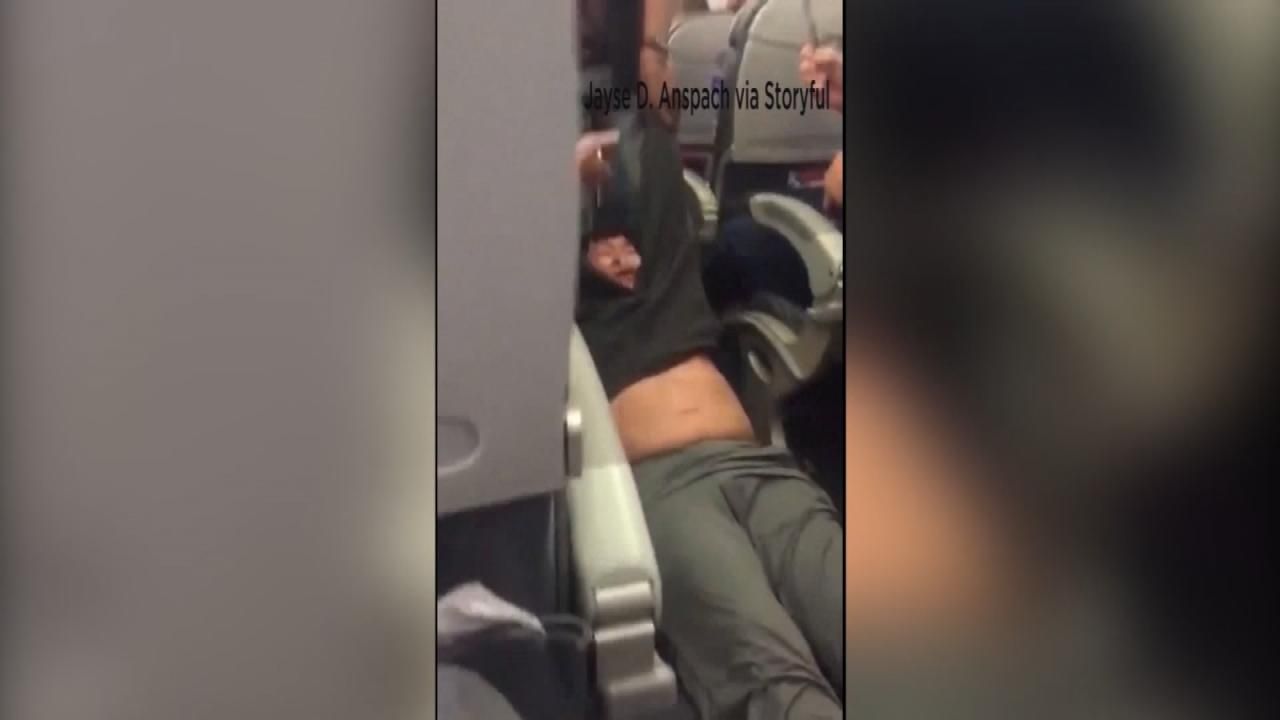 Lawyer: United Passenger Suffered Broken Nose, Concussion