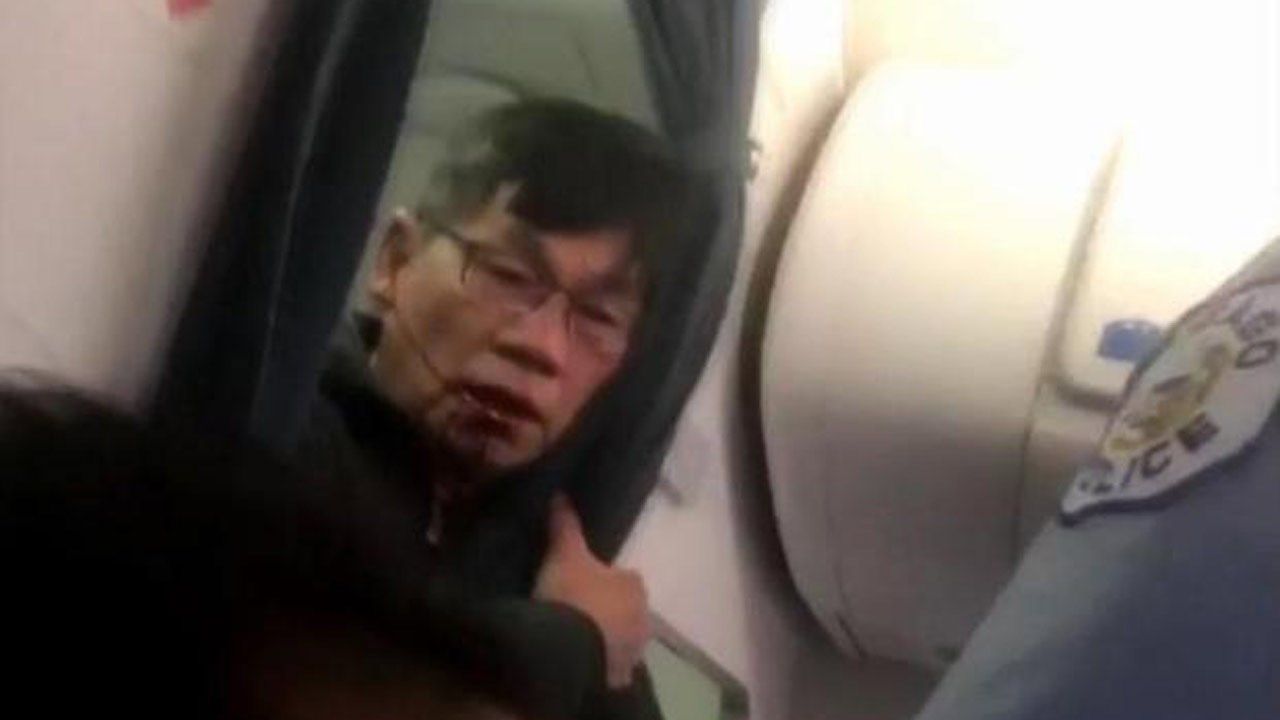 Physician Who Was Dragged Off Flight Settles With United