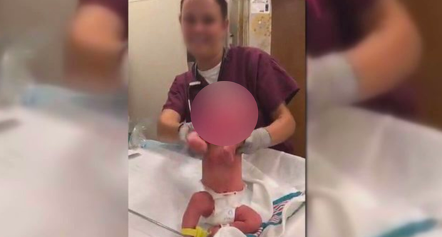 Jacksonville Hospital Removes Staffers Over "Inappropriate" Handling Of Newborn