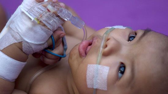 Respiratory Illness On The Rise In Oklahoma