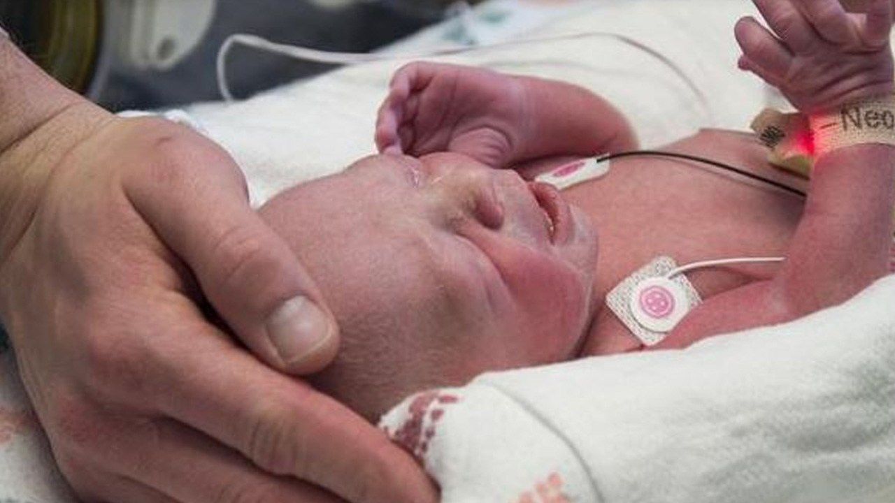 First Baby Born From Uterus Transplant In The U.S. Delivered In Texas