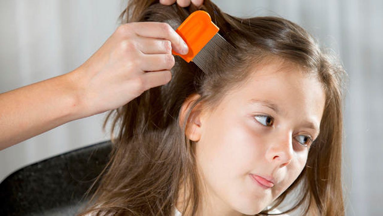 Study: Head Lice Resistant To Common Treatments