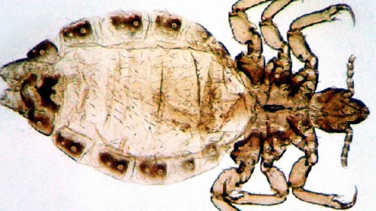 'Super Lice' A Concern As Kids Return To School