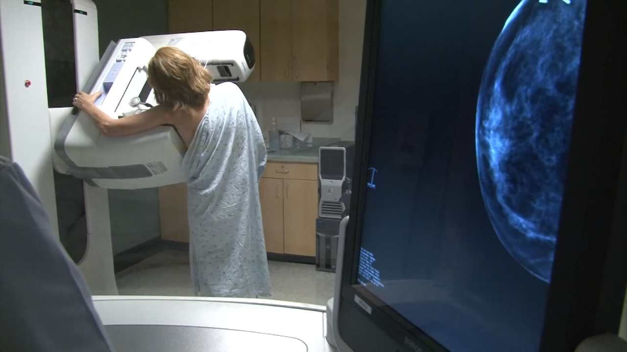 American Cancer Society Changes Mammogram Guidelines